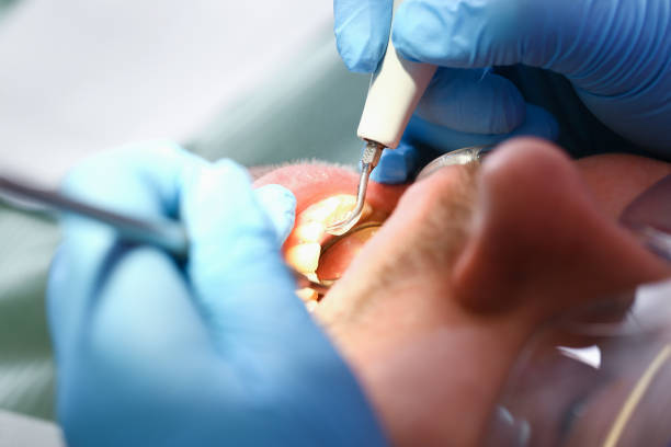 Best After-Hours Emergency Dentist in Lakes West, CT