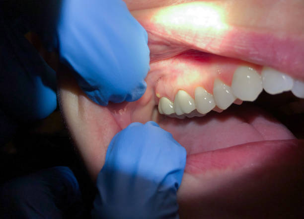 Best Emergency Treatment for Toothache in Lakes West, CT